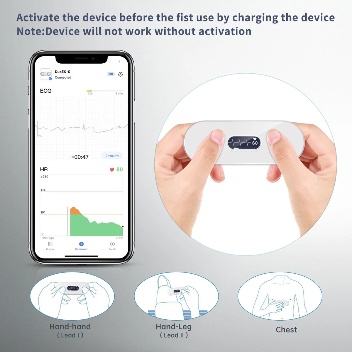 Handheld Bluetooth ECG Monitor with Screen Display G330