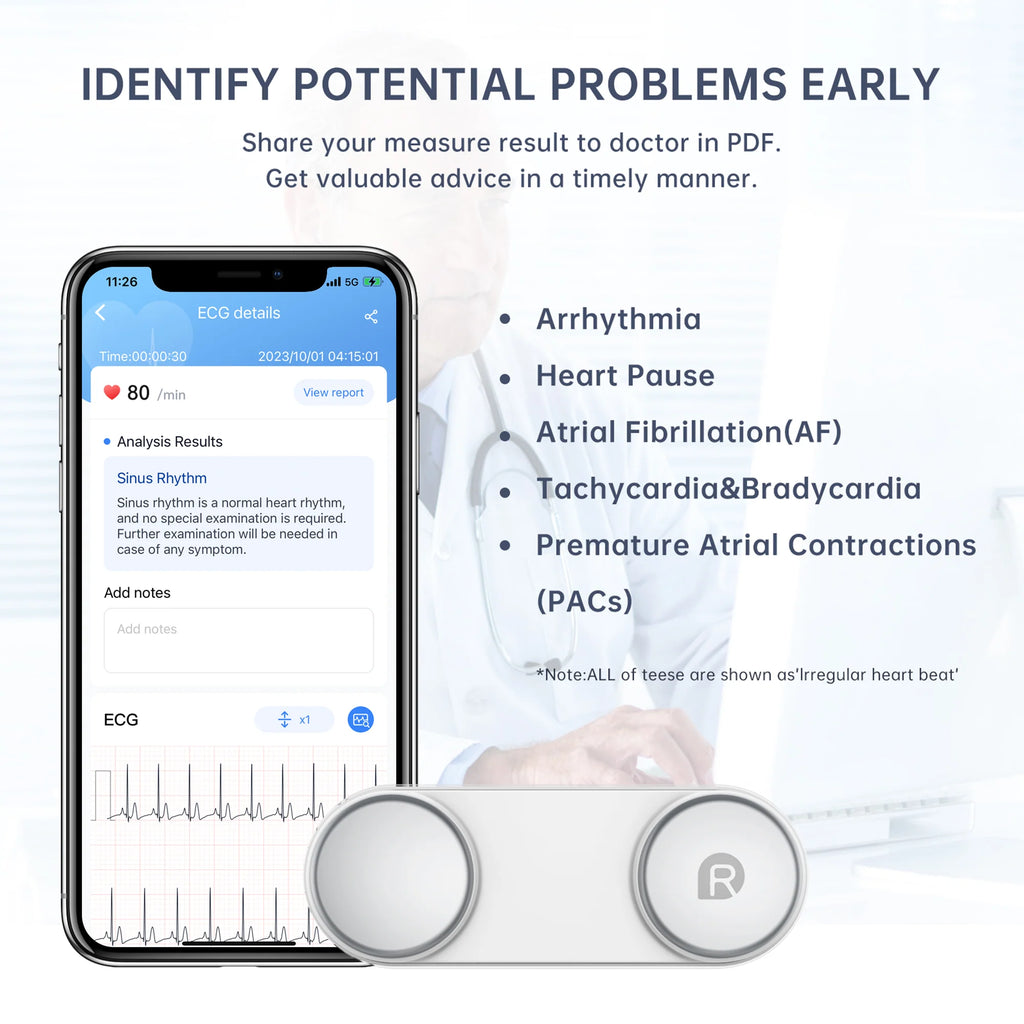 Handheld Bluetooth ECG Monitor with Screen Display G330